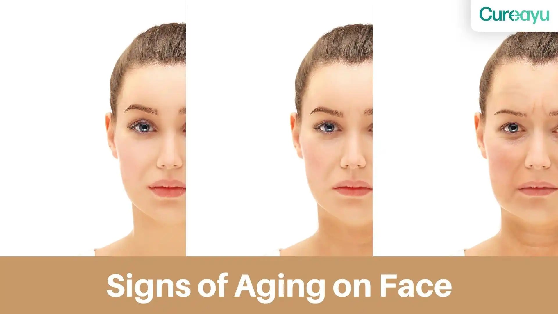 Signs of Aging on Face