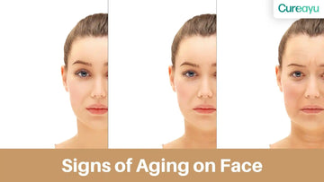 Signs of Aging on Face