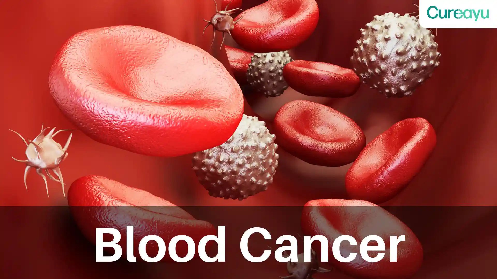 blood cancer 