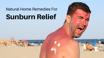 home remedies for sunburn