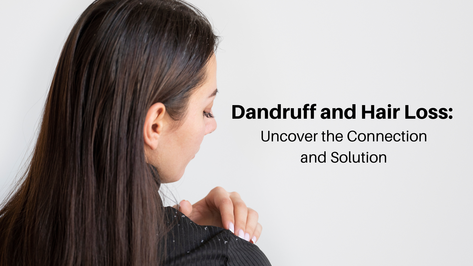 dandruff and hair loss 