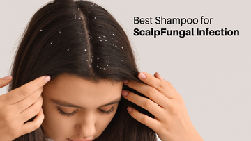 shampoo for fungal infection on scalp