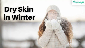 dry skin in winter