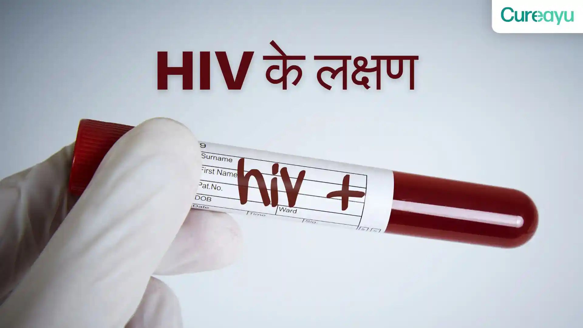 hiv ke lakshan