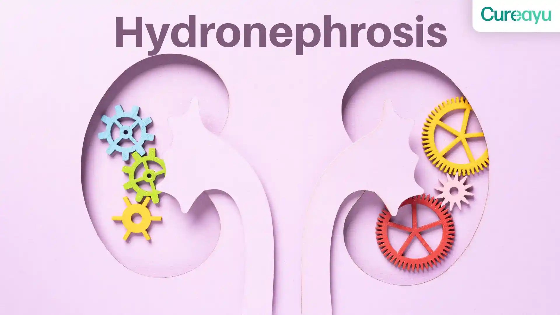 hydronephrosis