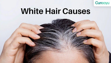 white hair solution