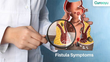 fistula symptoms