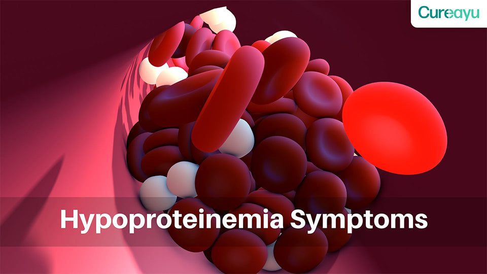 Understanding Hypoproteinemia Symptoms: Signs, Causes, and Treatment Options