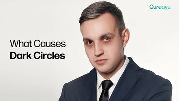 what causes dark circles